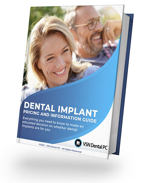 Dental Implant Pricing Guide