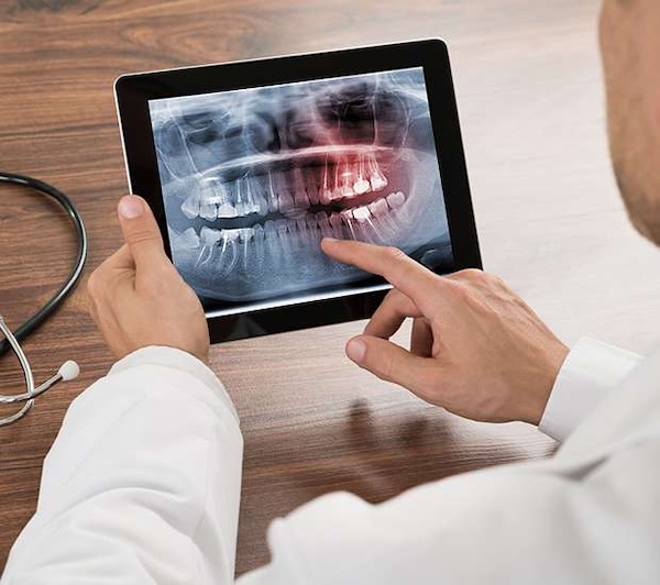Endodontics in Manalapan, NJ