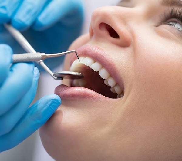 Dental Bonding in Manalapan, NJ