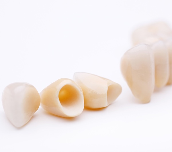 Dental Crowns in Manalapan, NJ