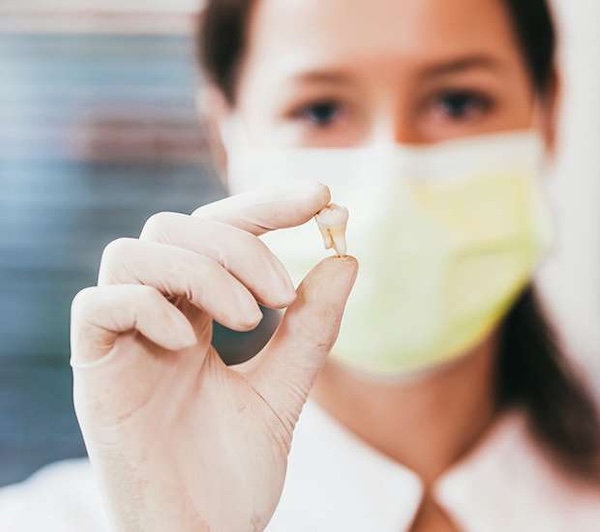 Tooth Extraction in Manalapan, NJ