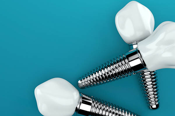 Understanding The Dental Implant Process