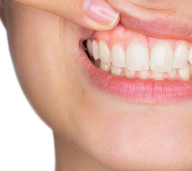 Manalapan Gum Disease